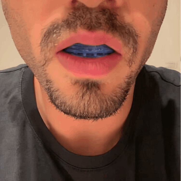 SleepZee Mouthpiece users ~Frank J.